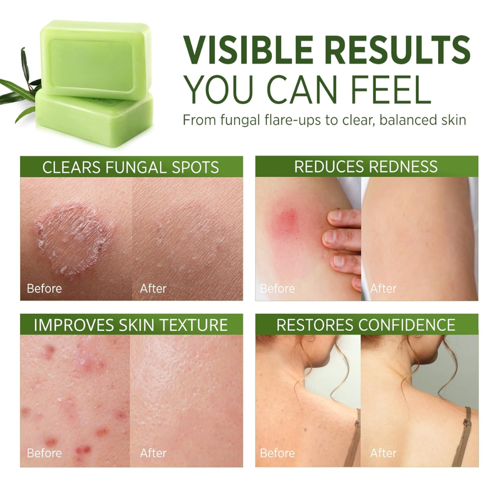 Tea Tree Oil Soap