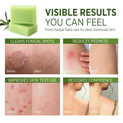 Tea Tree Oil Soap